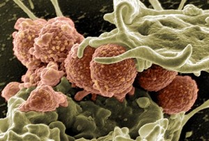 princ_photo_of_mrsa_and_white_blood_cell