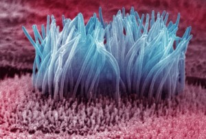 getty_rm_photo_of_cilia_in_lung